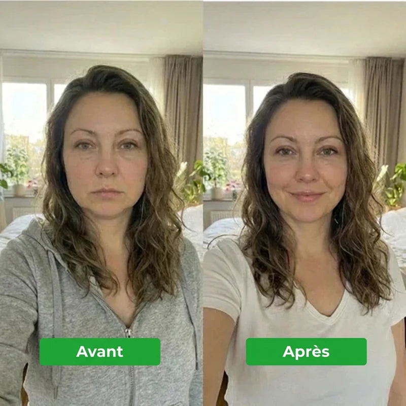 Drainant Lymphatique Erlona®