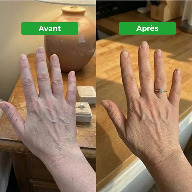 Drainant Lymphatique Erlona®