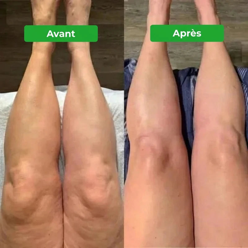 Drainant Lymphatique Erlona®