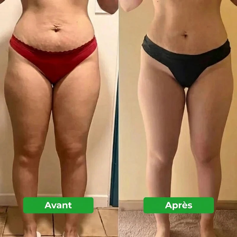 Drainant Lymphatique Erlona®