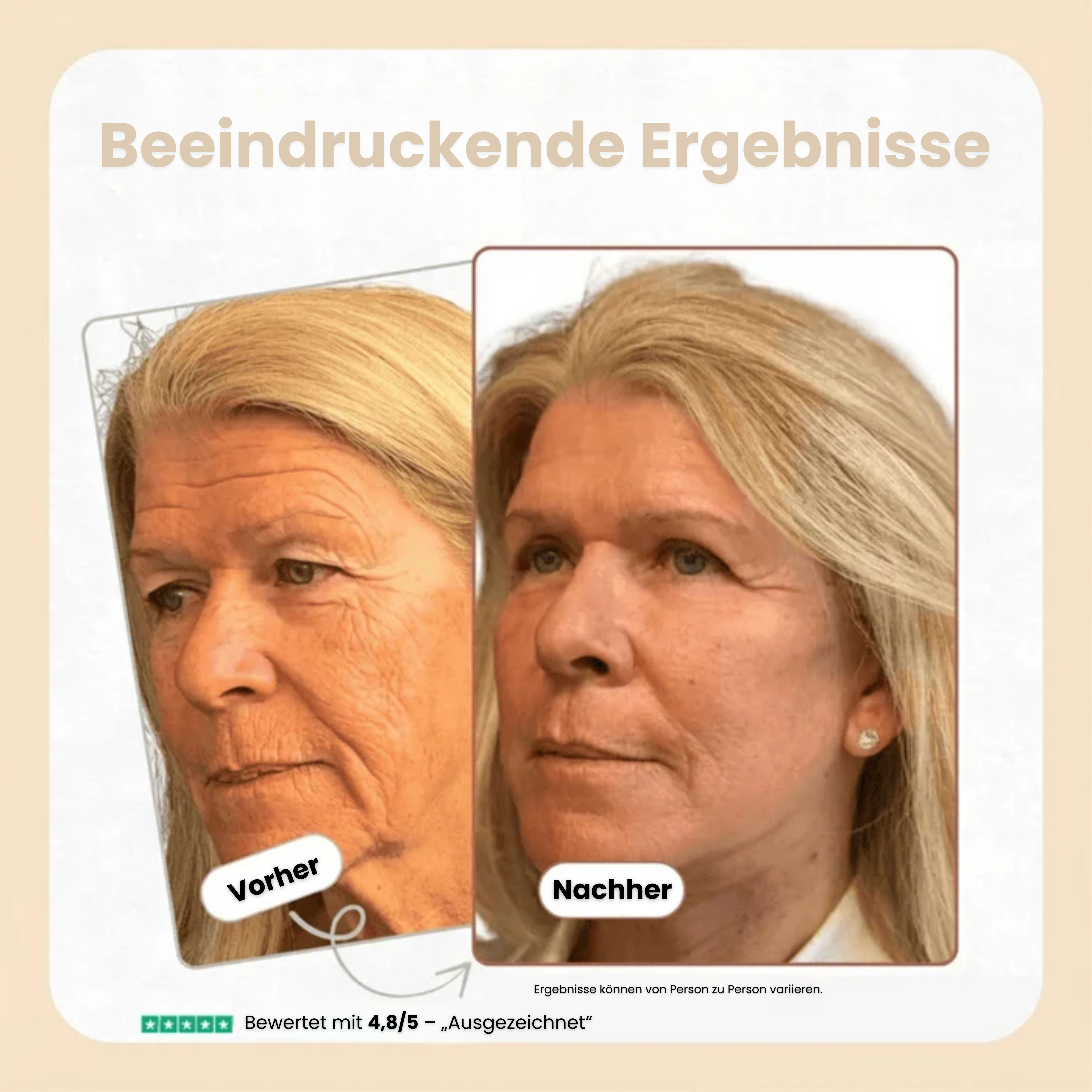 Anti-Falten-Stick mit Kalzium – Strafft & Verjüngt das Gesicht | Kalzium- & Kollagen-Formel mit patentiertem Ribornic-Komplex